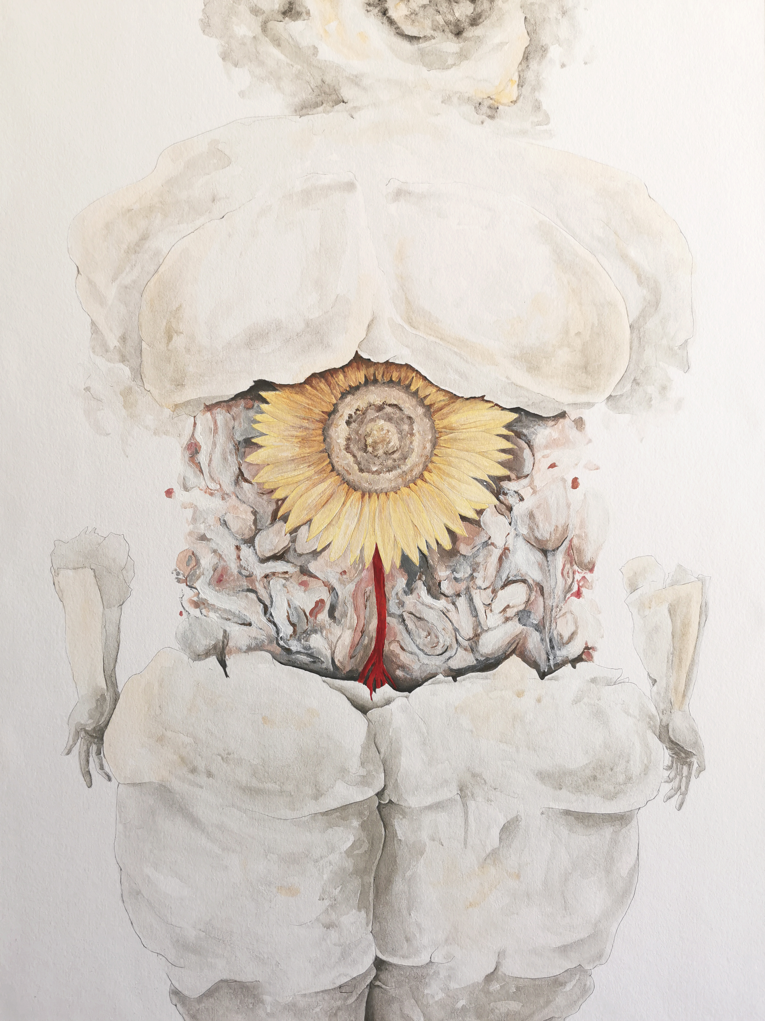 Internal dysfunction - 1